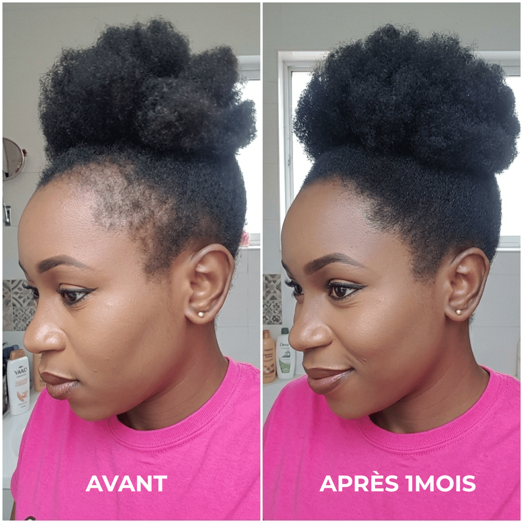 Norgecare® - Sérum anti-chute cheveux
