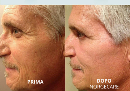 NORGECARE® - Balsamo Anti-Età Idratante