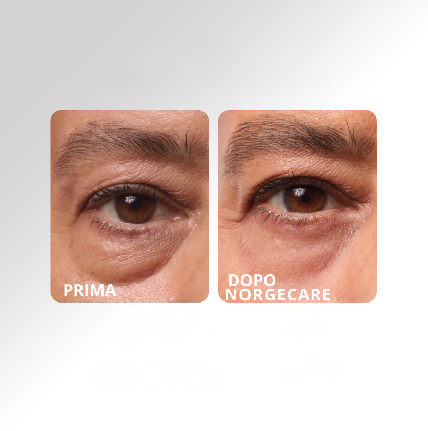 NORGECARE® - Balsamo Anti-Età Idratante