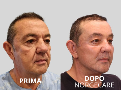 NORGECARE® - Balsamo Anti-Età Idratante