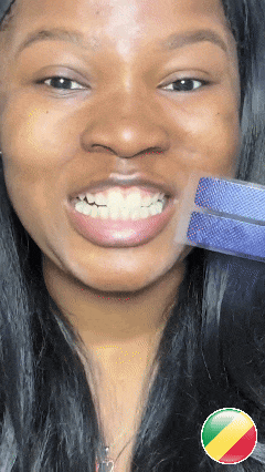 Norgecare® - Bandes Blanchissantes Violettes
