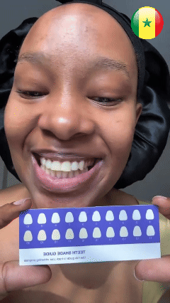 Norgecare® - Bandes Blanchissantes Violettes